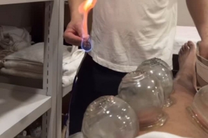 嘗試東方神秘力量！北京男籃外援斯佩爾曼曬拔火罐視頻