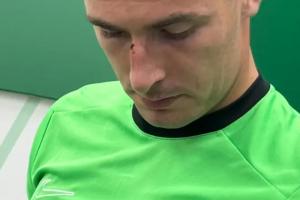 VAR介入不犯規！佩尼亞和維尼修斯相撞+遭絕平，賽后鼻梁留下傷痕